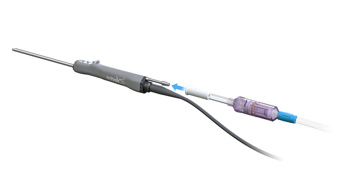 Knorpel/Knochenläsionen sportärztezeitung